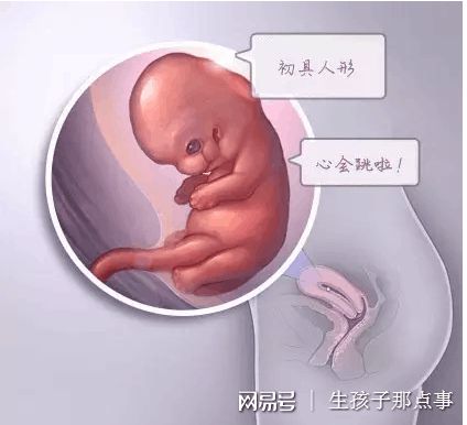 反复流产案例